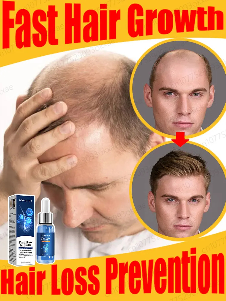 Hair Growth Products Fast Hair Growth Oil Essence For Men Women Anti Hair Loss E