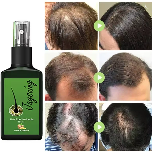 Hair Growth Spray Effective Nourishing Root Hair Thick Growth Liquid Anti Hair Loss Ginger Anti-fall Scalp Massage Repair Spray