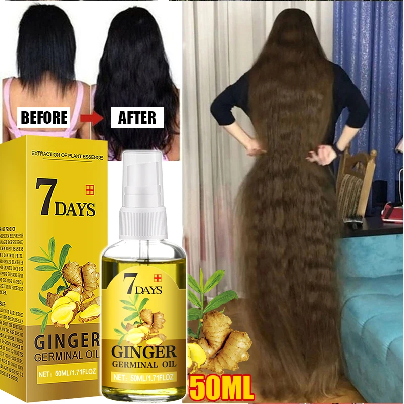 Fast Hair Growth Men Women Ginger Growth Hair Oil Treatment Anti Hair Loss Scalp