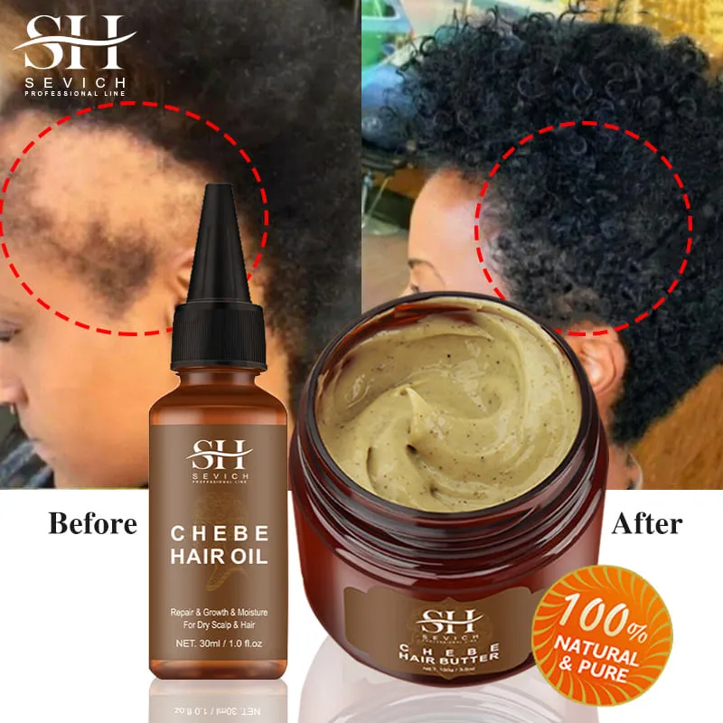Fast Hair Growth Set Chebe Oil Traction Alopecia Hair Mask Anti Break Loss Hair 