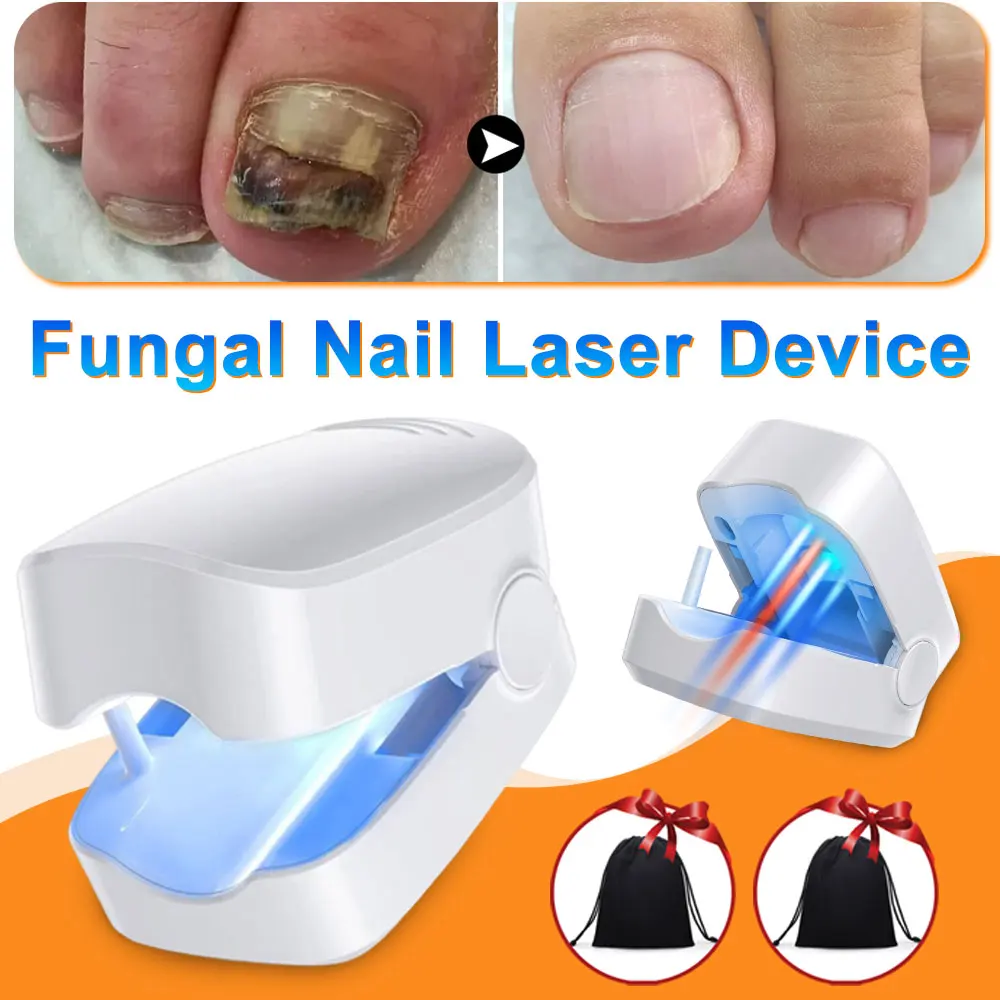 Fungal Nail Laser Device Nail Fungus Laser Cure Machine Repair Toenail Fingernai