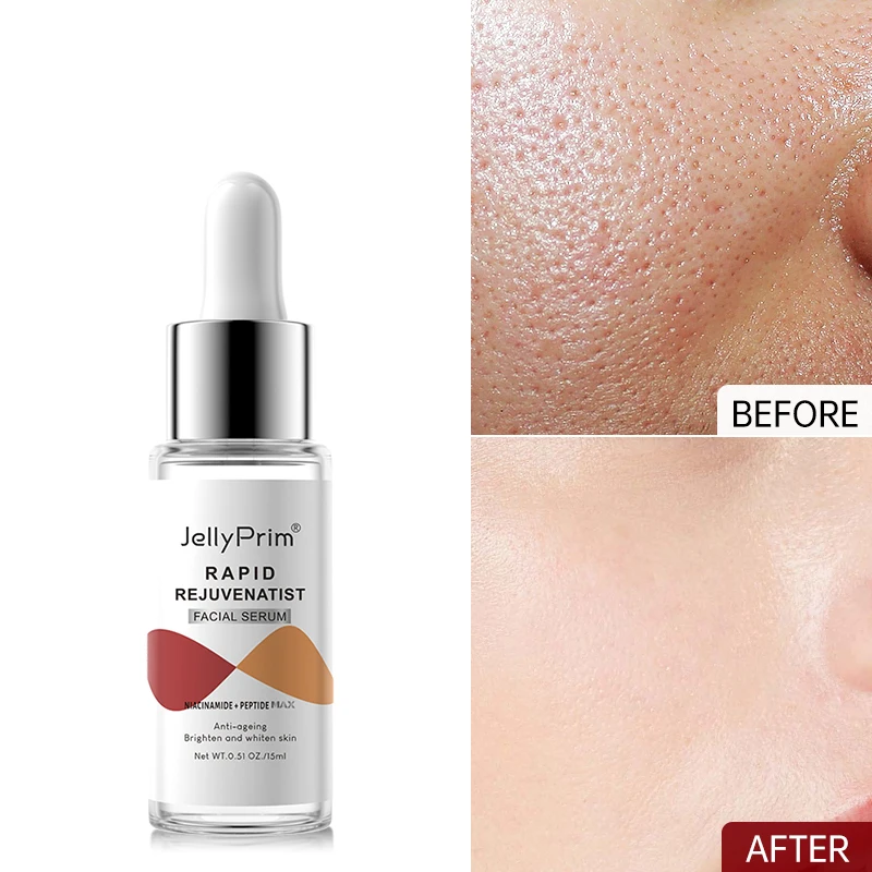 Niacinamide Serum Dark Spot Remover Face Serum Whitening For Glowing Pore Shrink