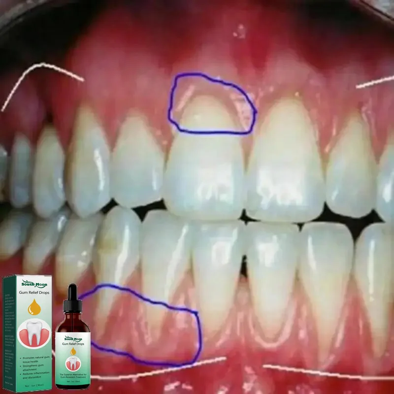30ml Quickly Repair Of Cavities Caries Mousse Teeth Clean Whiten Remove Yellow P
