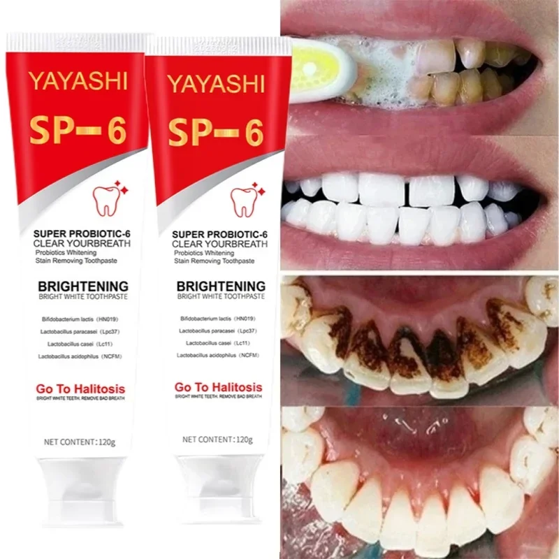Probiotic Toothpaste SP-6 Whitening Teeth Remov Dental Plaque and Stains Teeth W